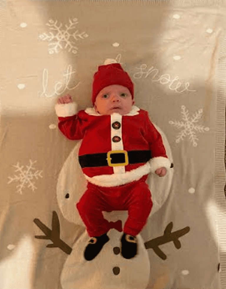 طفل لا يشبه والديه.. حالة نادرة تثير حيرة الأطباء