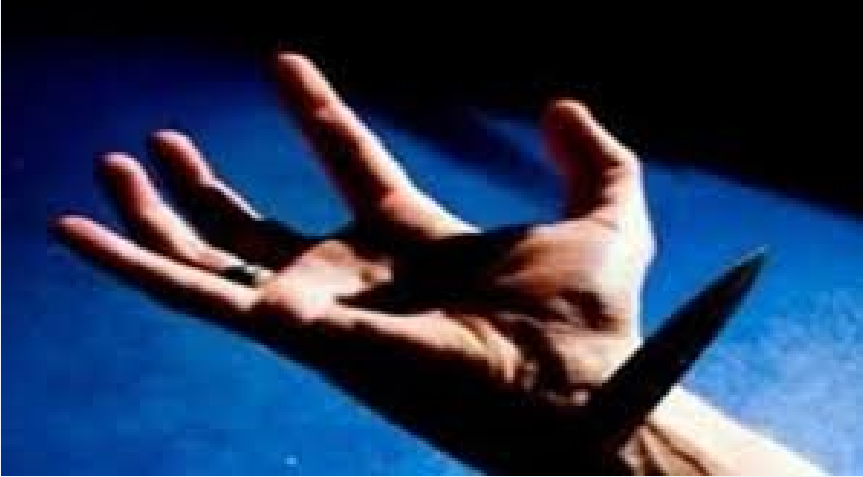 ياخبر.. جنوب سودانيين يقطعون يد مواطن مصري